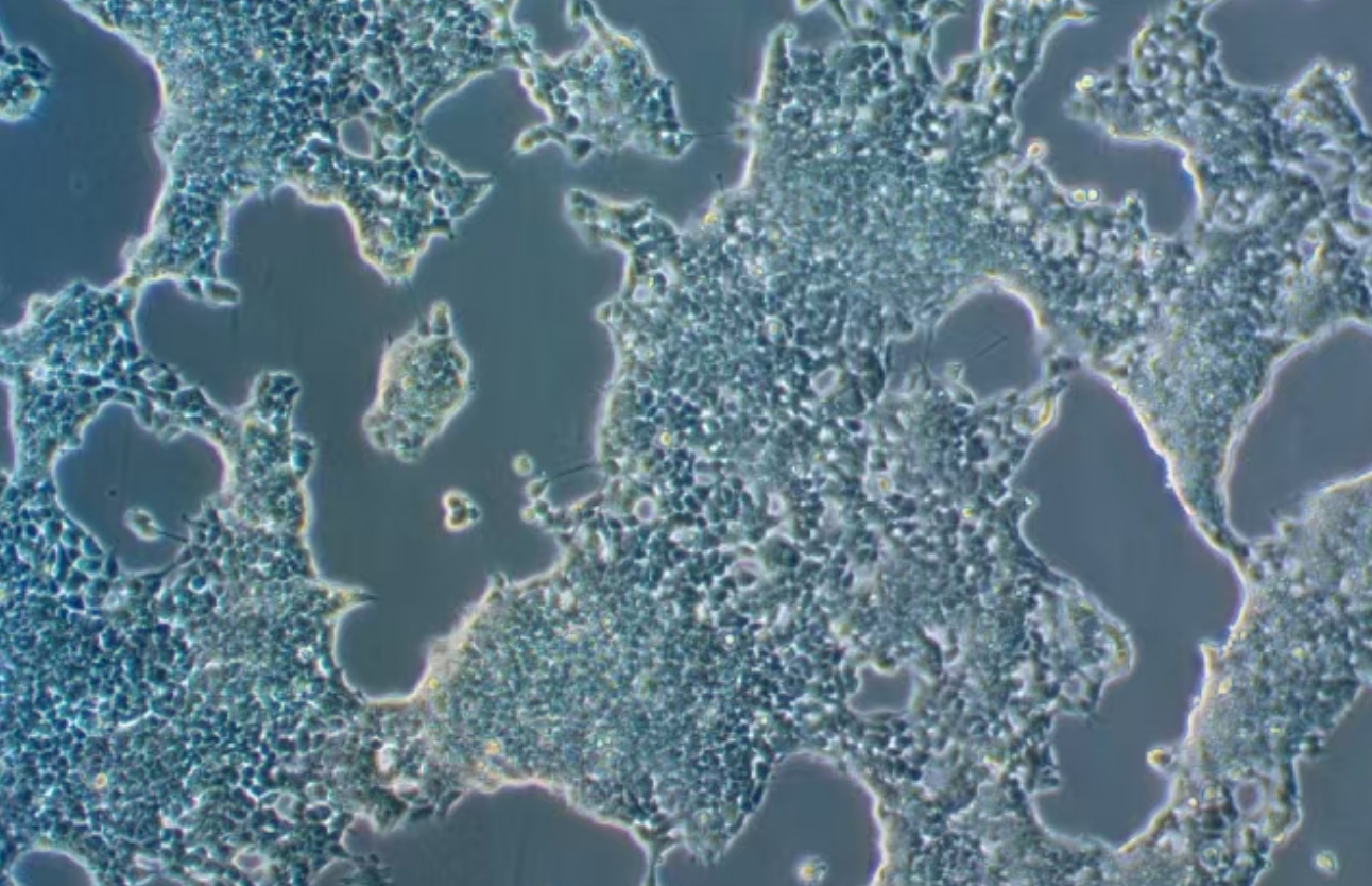 人小細胞肺癌 NCI-H2227(STR鑒定正確)