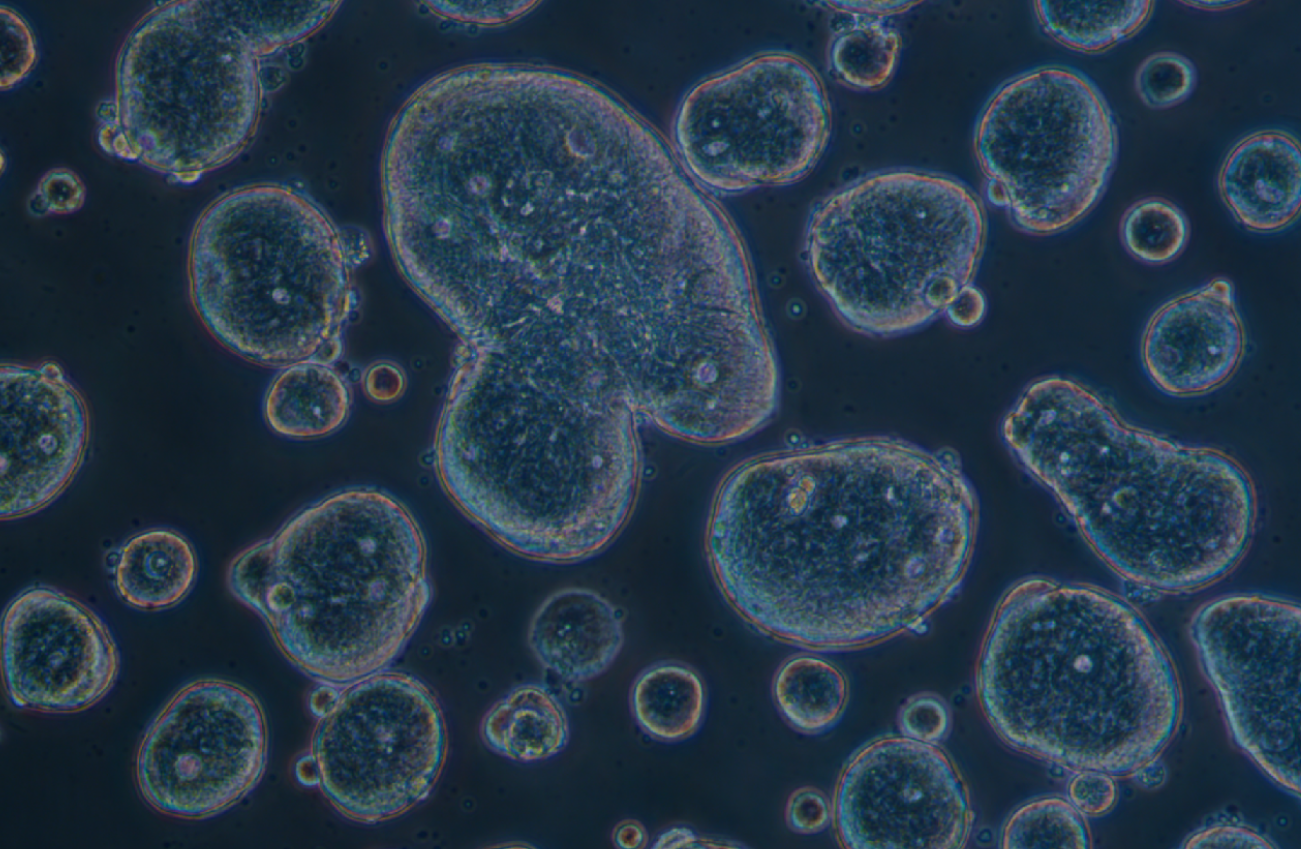 人結腸癌細胞SW403(STR鑒定正確)