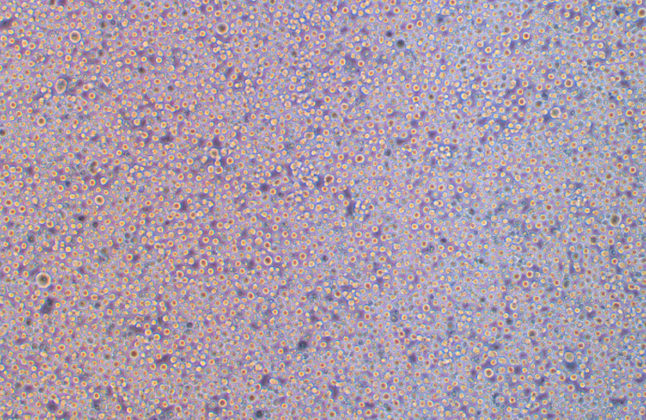 人漿細胞白血病ARH-77(STR鑒定正確)