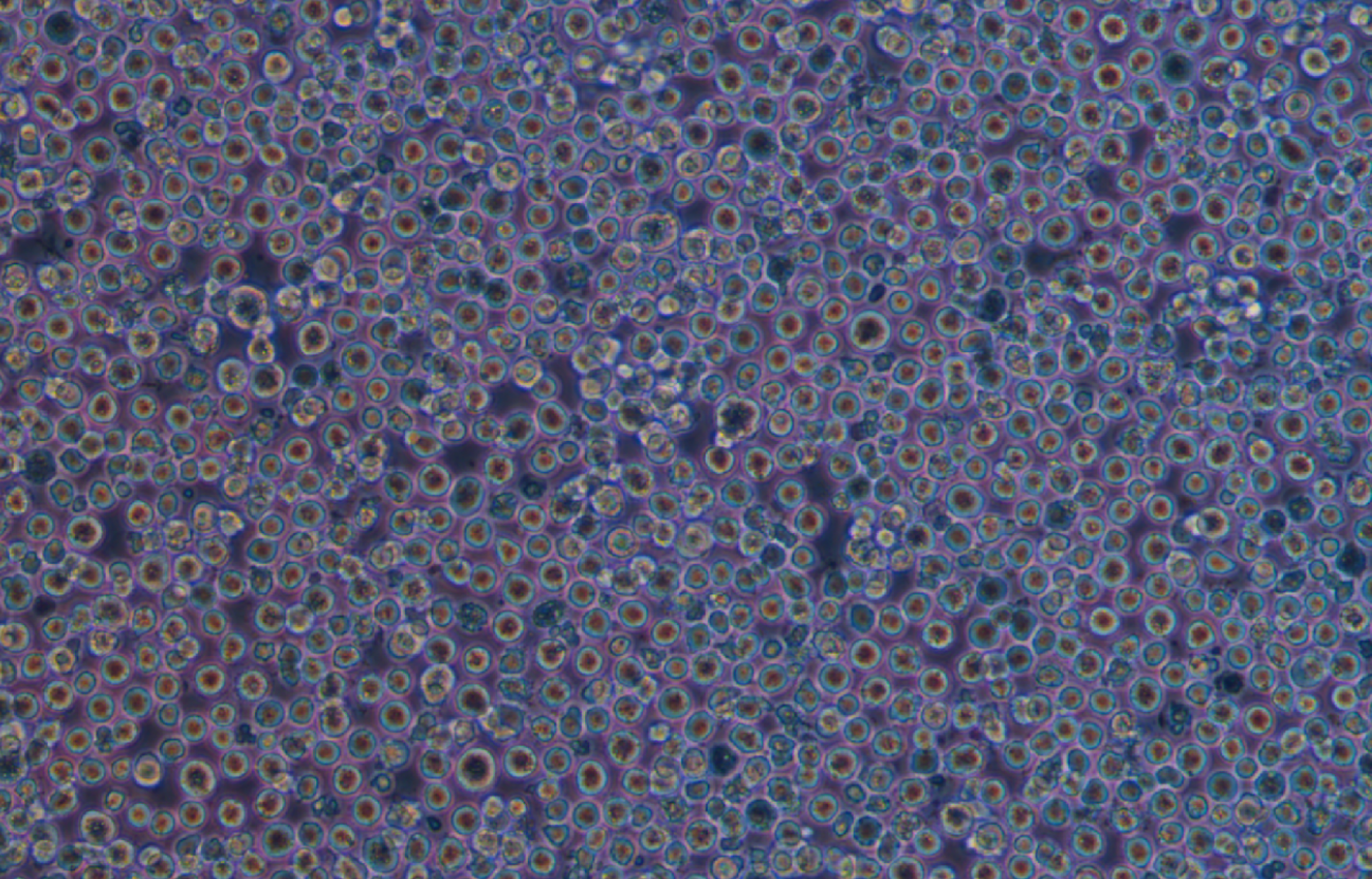 人漿細胞白血病ARH-77(STR鑒定正確)