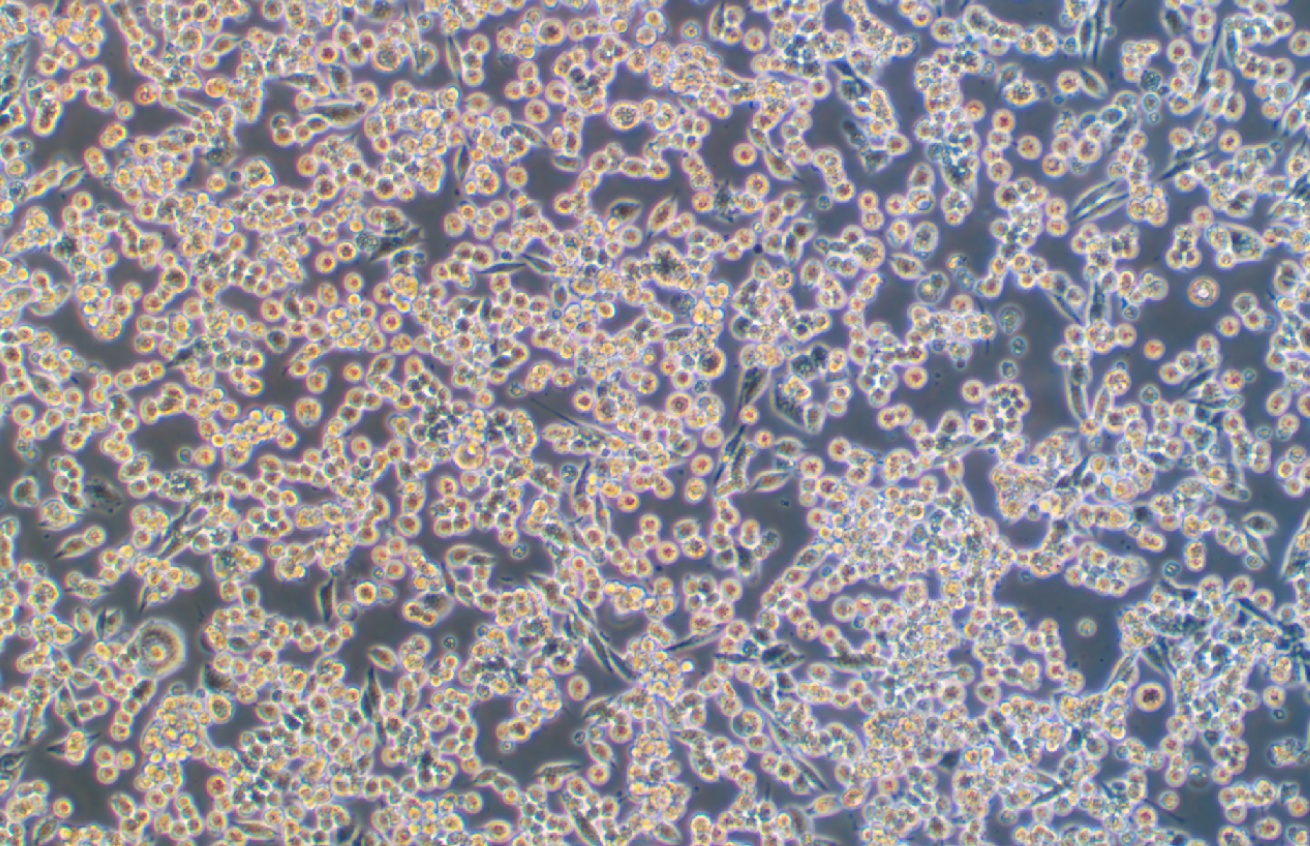 小鼠肺癌細胞LLC(STR鑒定正確)