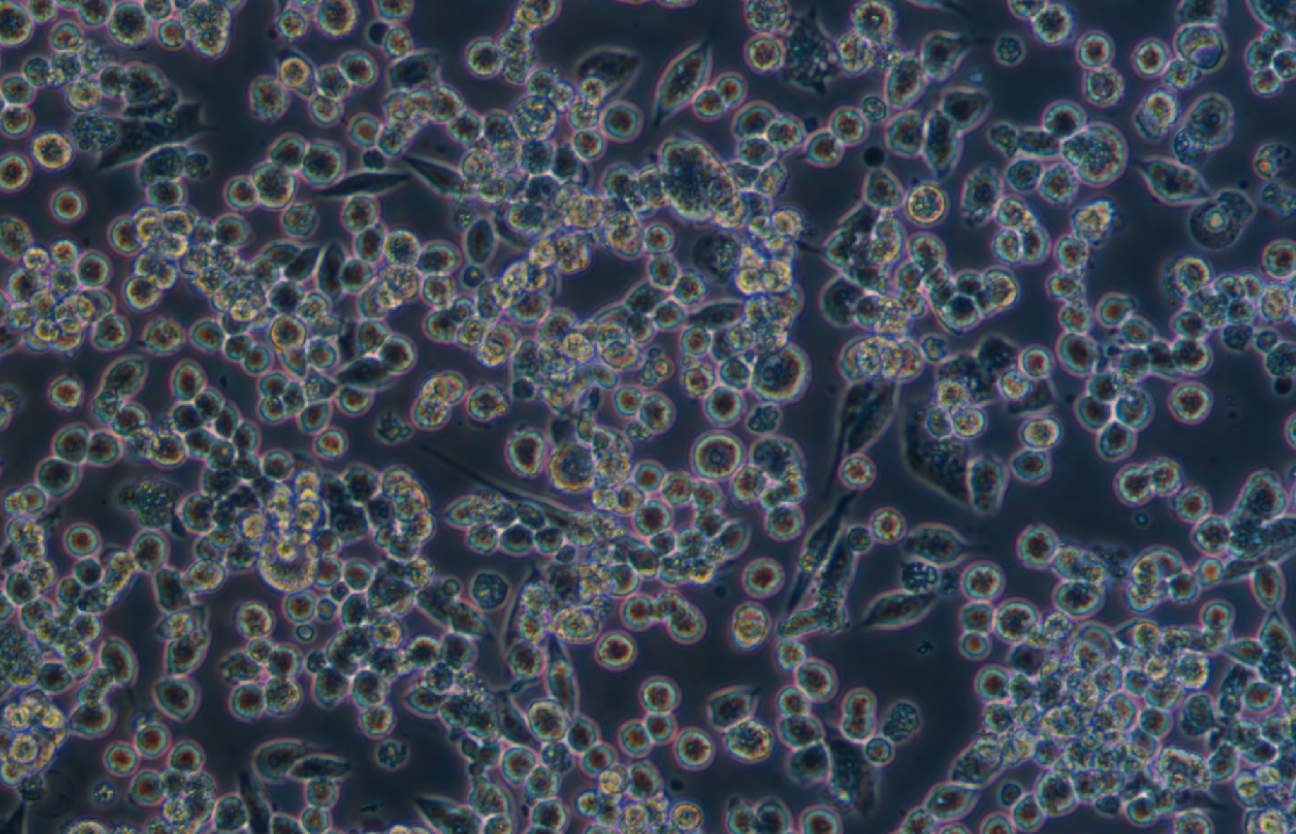 小鼠肺癌細胞LLC(STR鑒定正確)