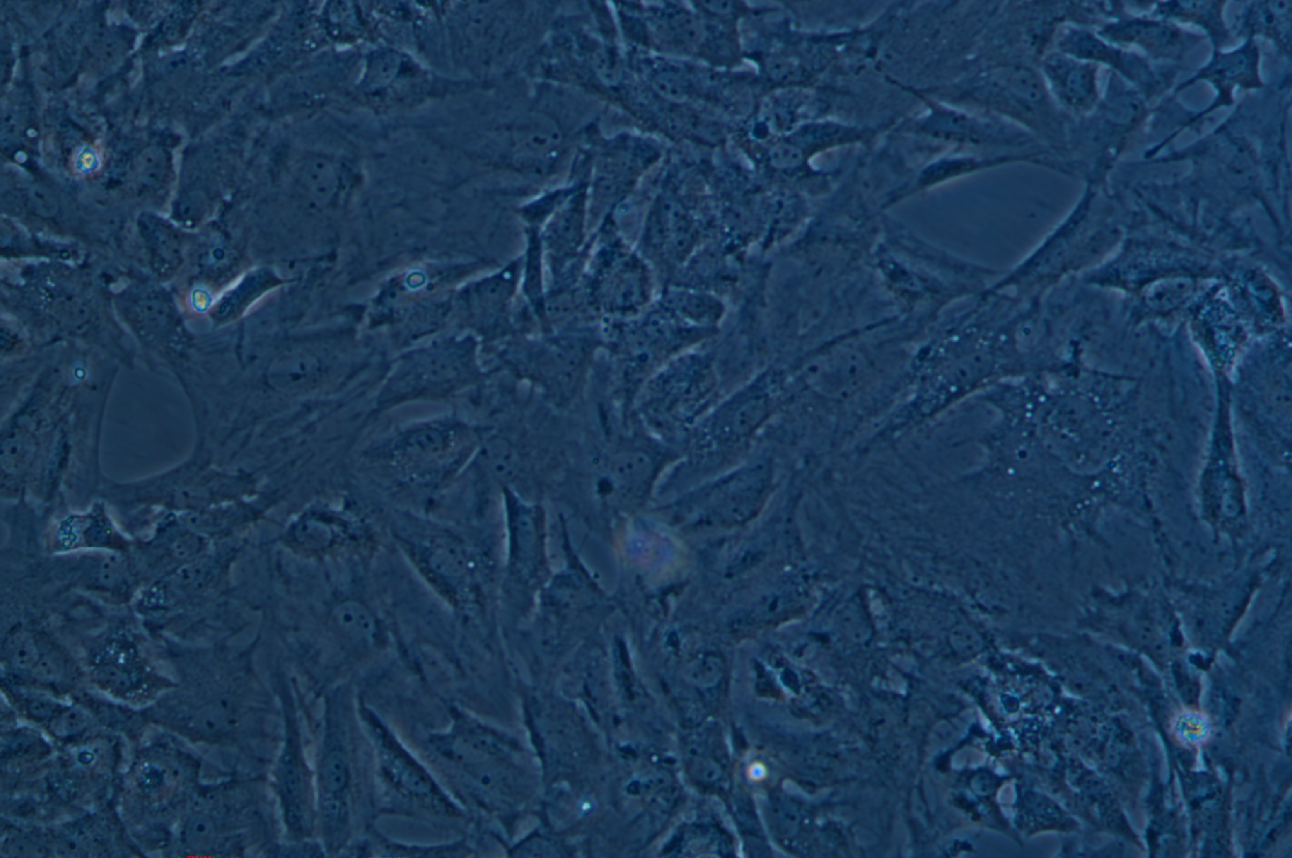 人真皮成纖維細胞永生化(SV40轉染)?HSF