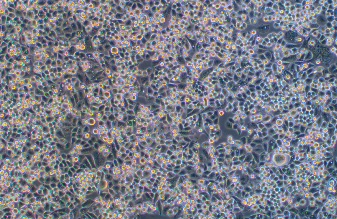 人宮頸癌細胞C33A(STR鑒定正確)