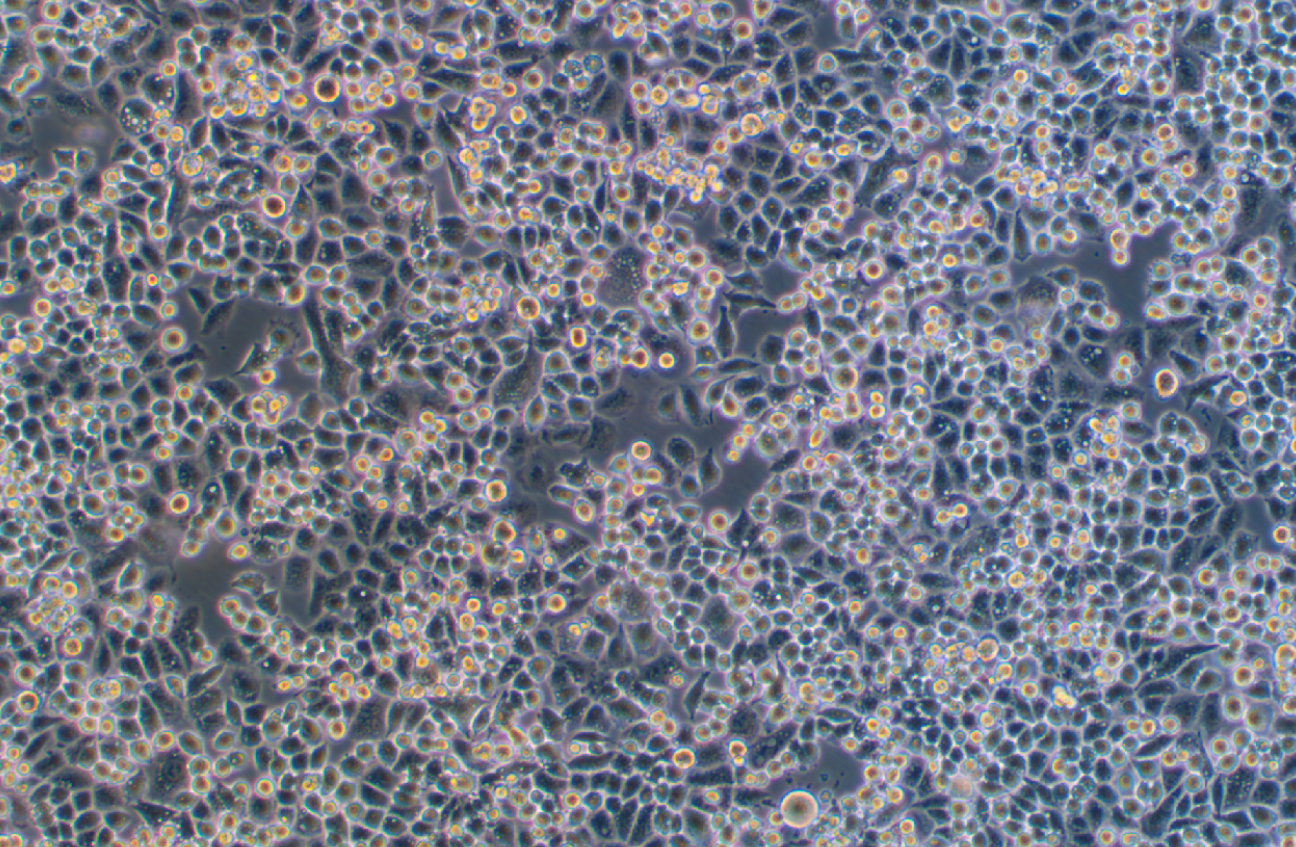 人宮頸癌細胞C33A(STR鑒定正確)