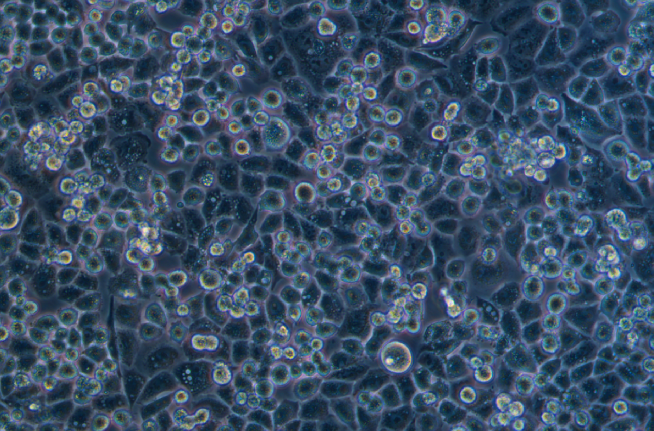 人宮頸癌細胞C33A(STR鑒定正確)