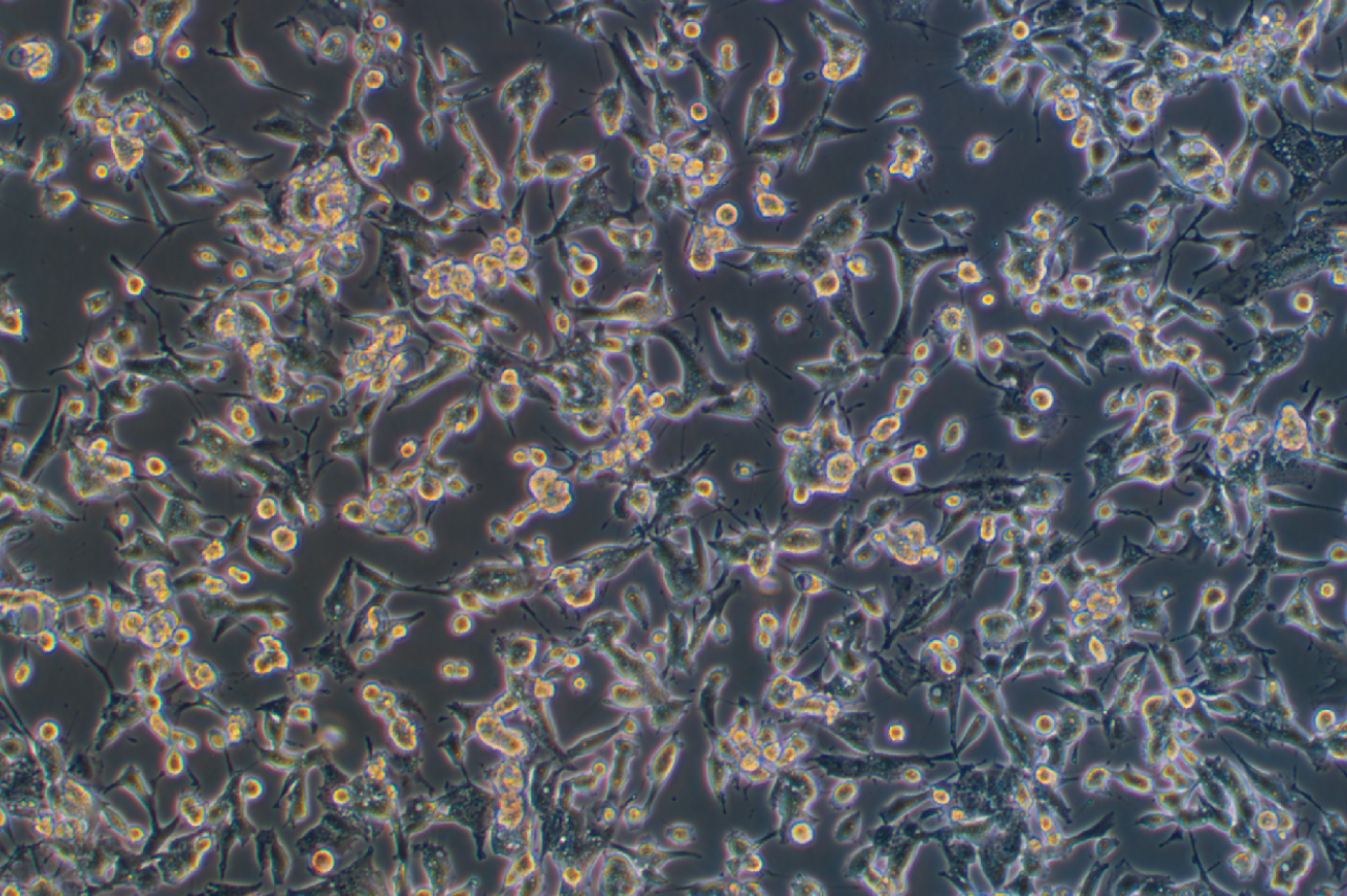 人乳腺癌細(xì)胞MDA-MB-436(STR鑒定正確)