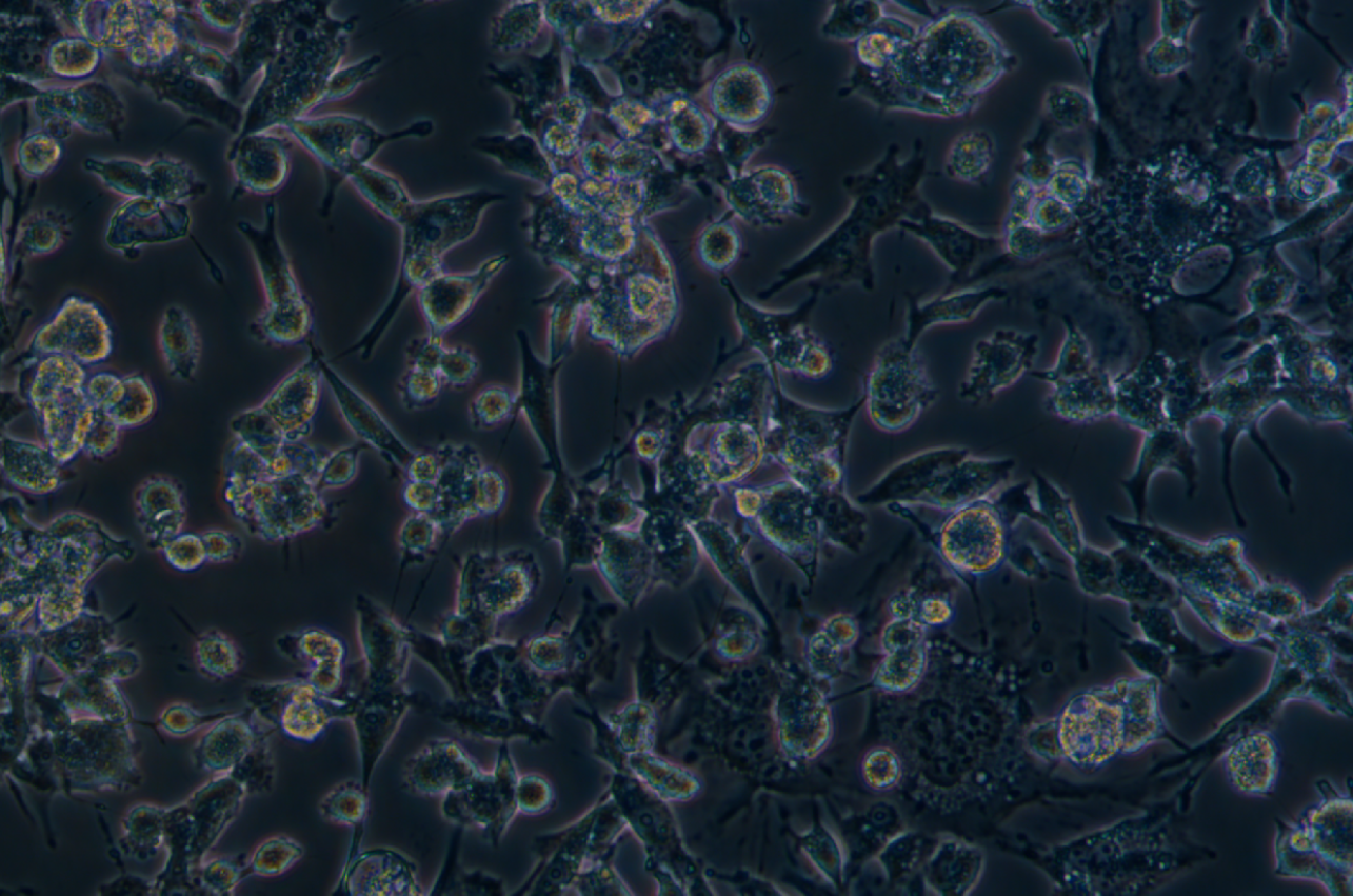 人乳腺癌細(xì)胞MDA-MB-436(STR鑒定正確)