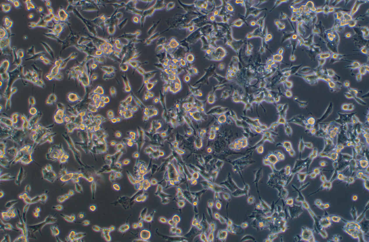 人乳腺癌細(xì)胞MDA-MB-436(STR鑒定正確)