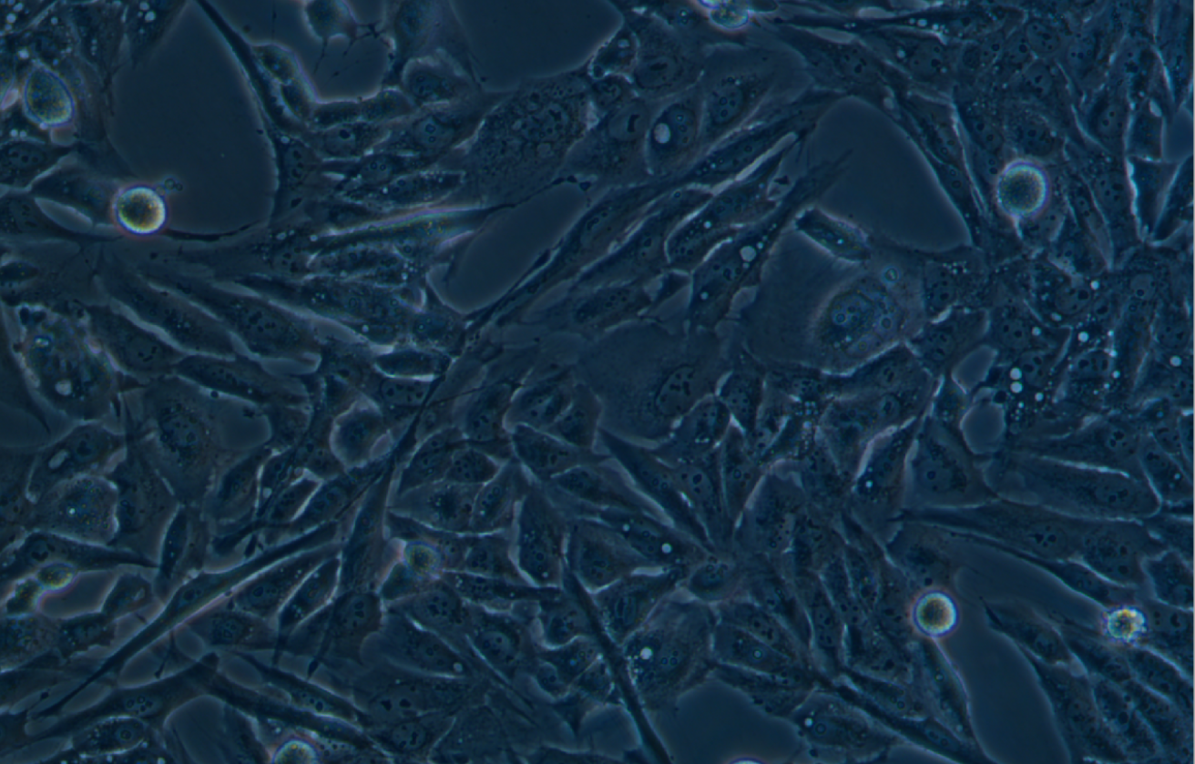 人胃粘膜細(xì)胞GES-1(STR鑒定正確)