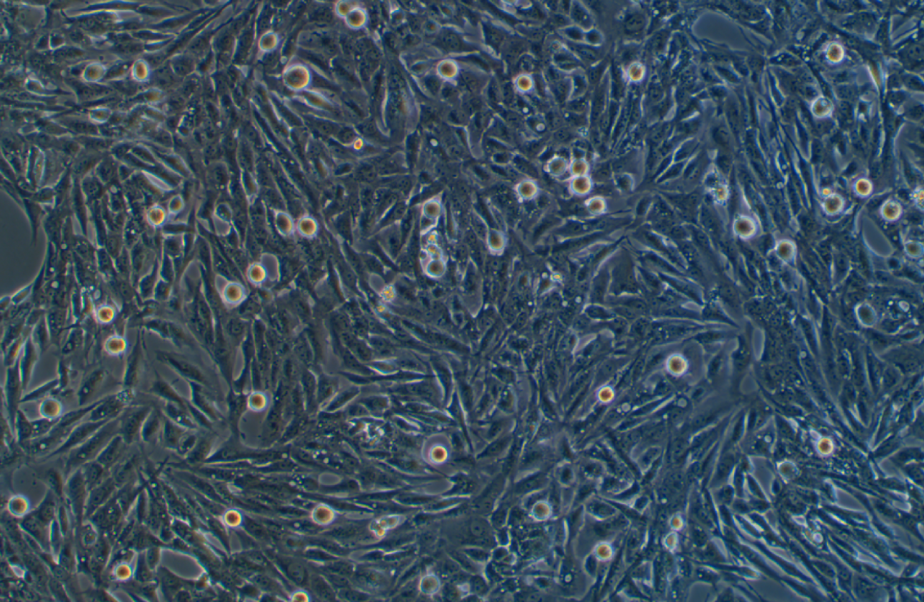 人胃粘膜細(xì)胞GES-1(STR鑒定正確)