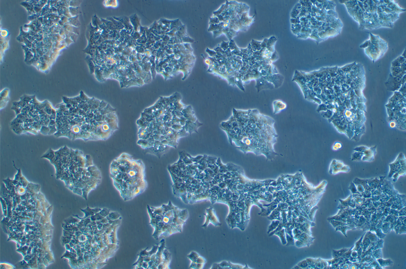 人乳腺導管癌細胞帶熒光素酶BT474+LUC (STR鑒定正確)