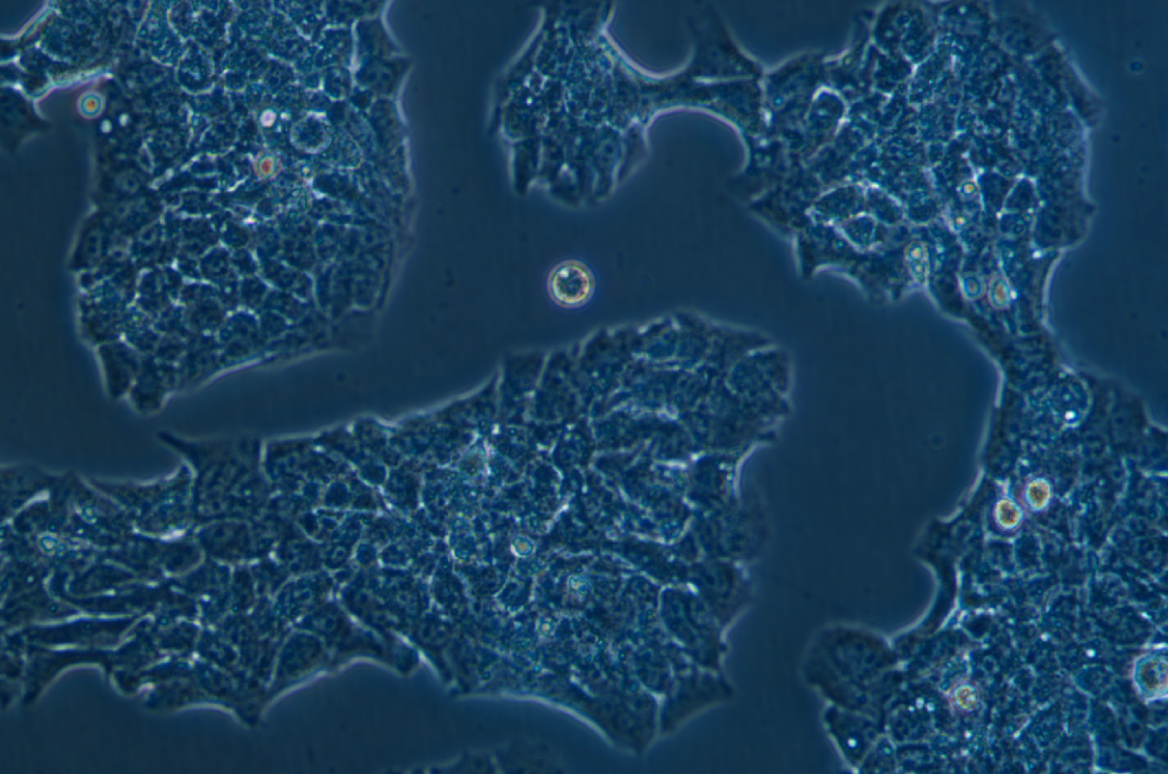 人乳腺導管癌細胞帶熒光素酶BT474+LUC (STR鑒定正確)