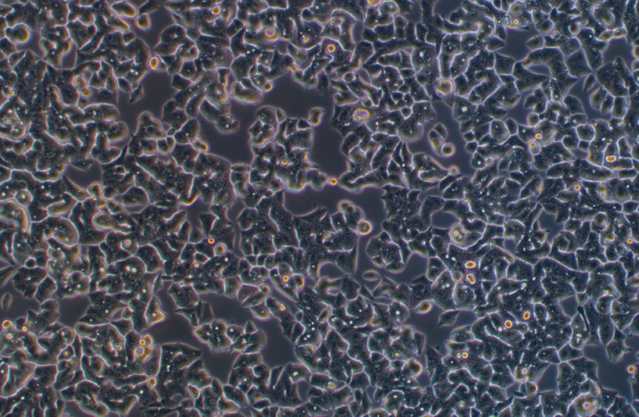 人結腸腺癌細胞LS 180(STR鑒定正確)