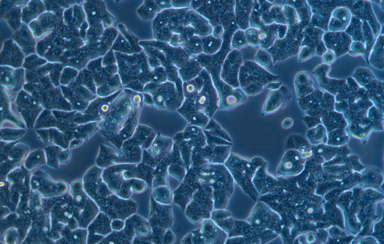 人結腸腺癌細胞LS 180(STR鑒定正確)