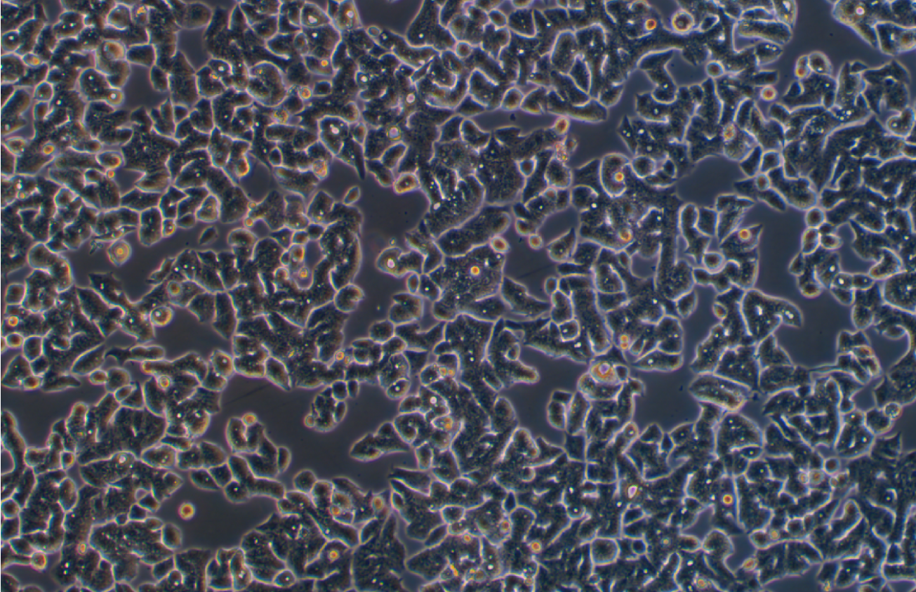 人結腸腺癌細胞LS 180(STR鑒定正確)