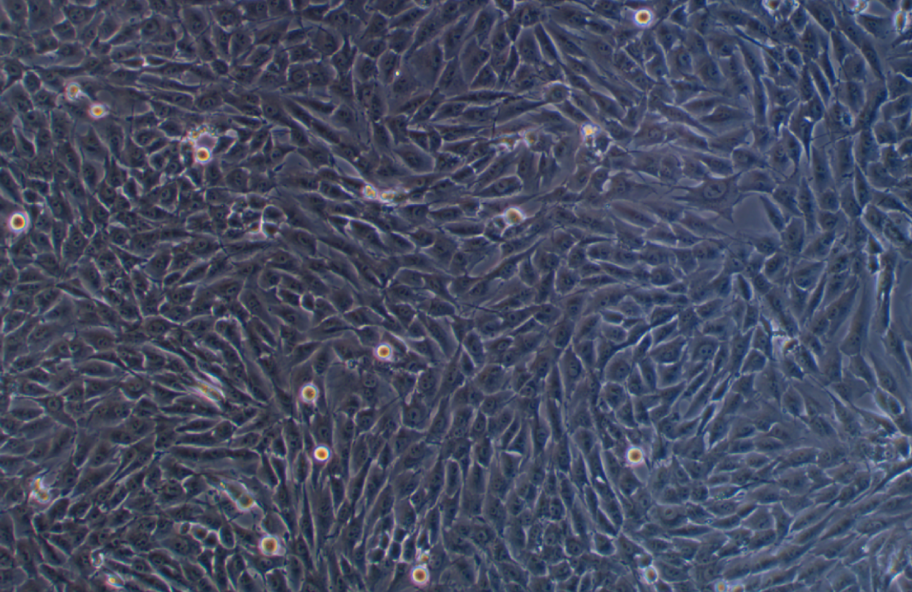 人成骨肉瘤細(xì)胞MG-63(STR鑒定正確)