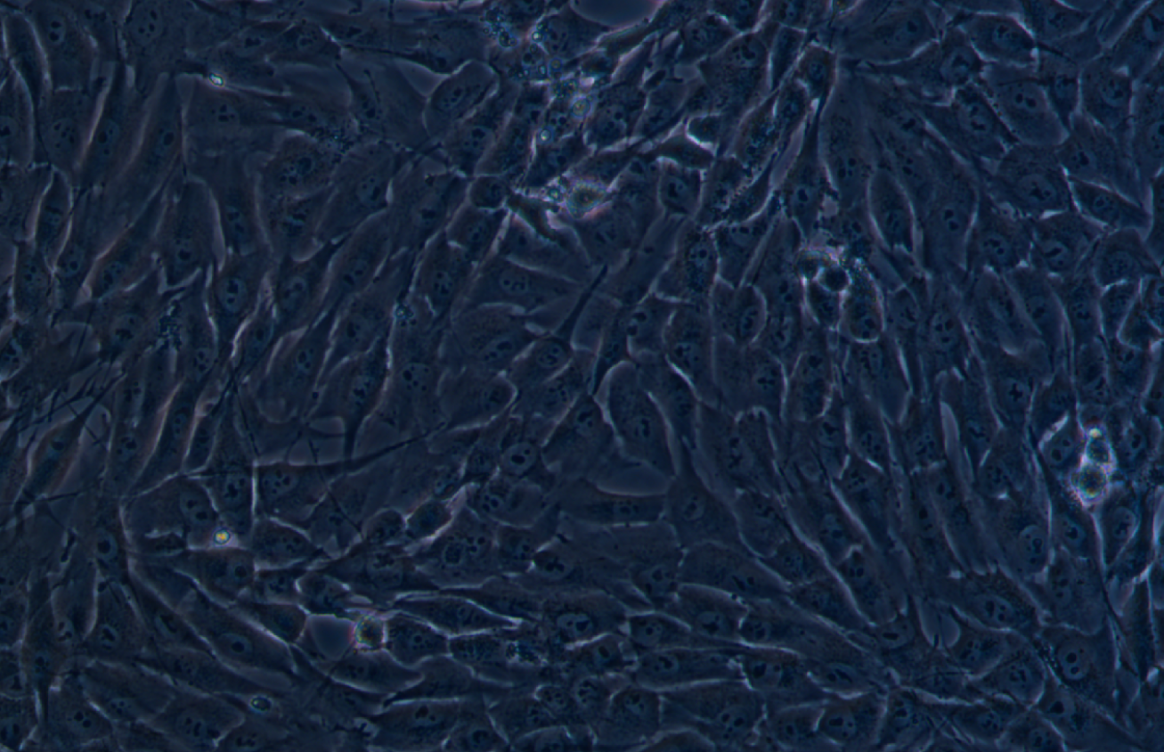 人成骨肉瘤細(xì)胞MG-63(STR鑒定正確)