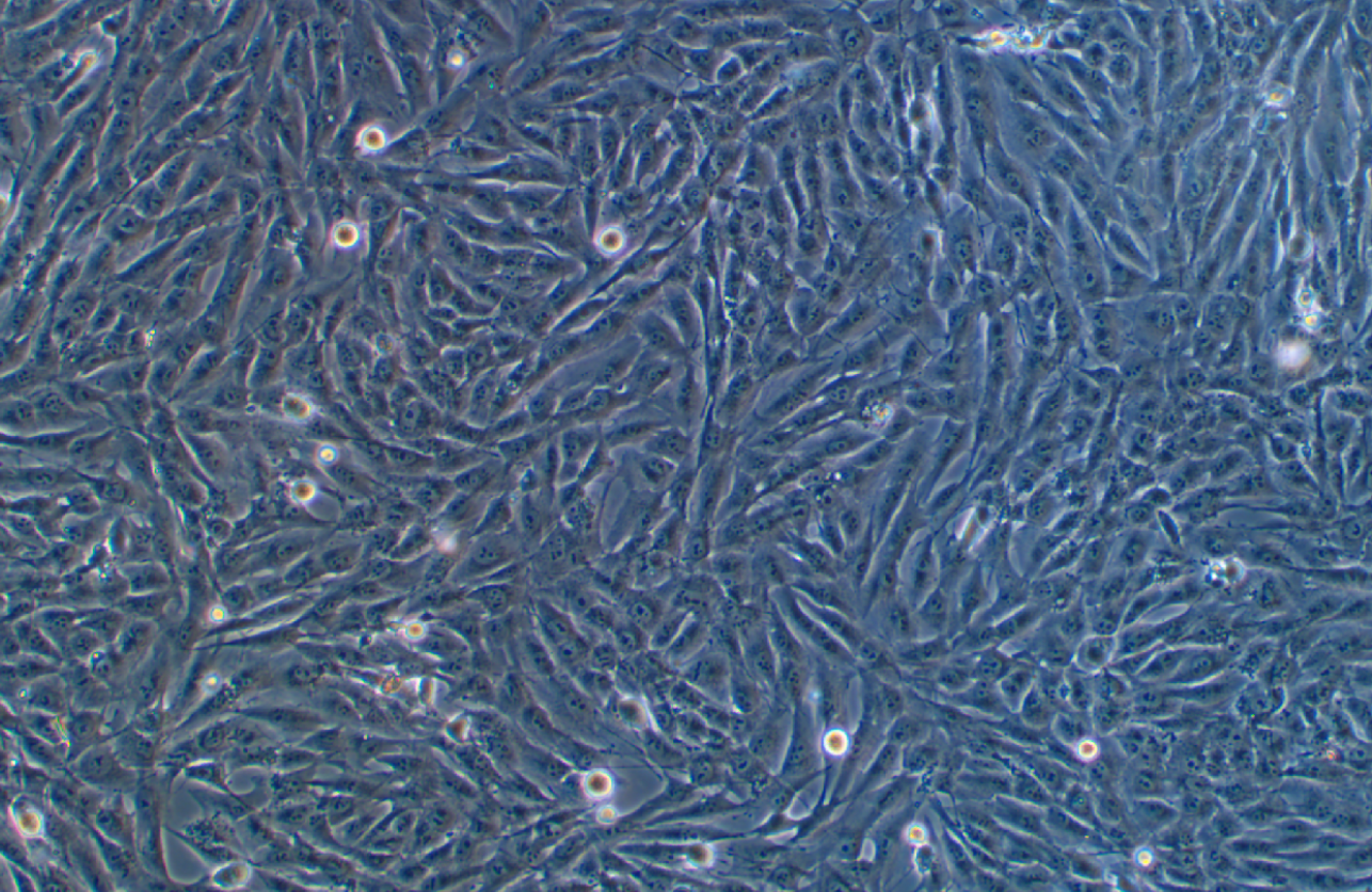 人成骨肉瘤細(xì)胞MG-63(STR鑒定正確)