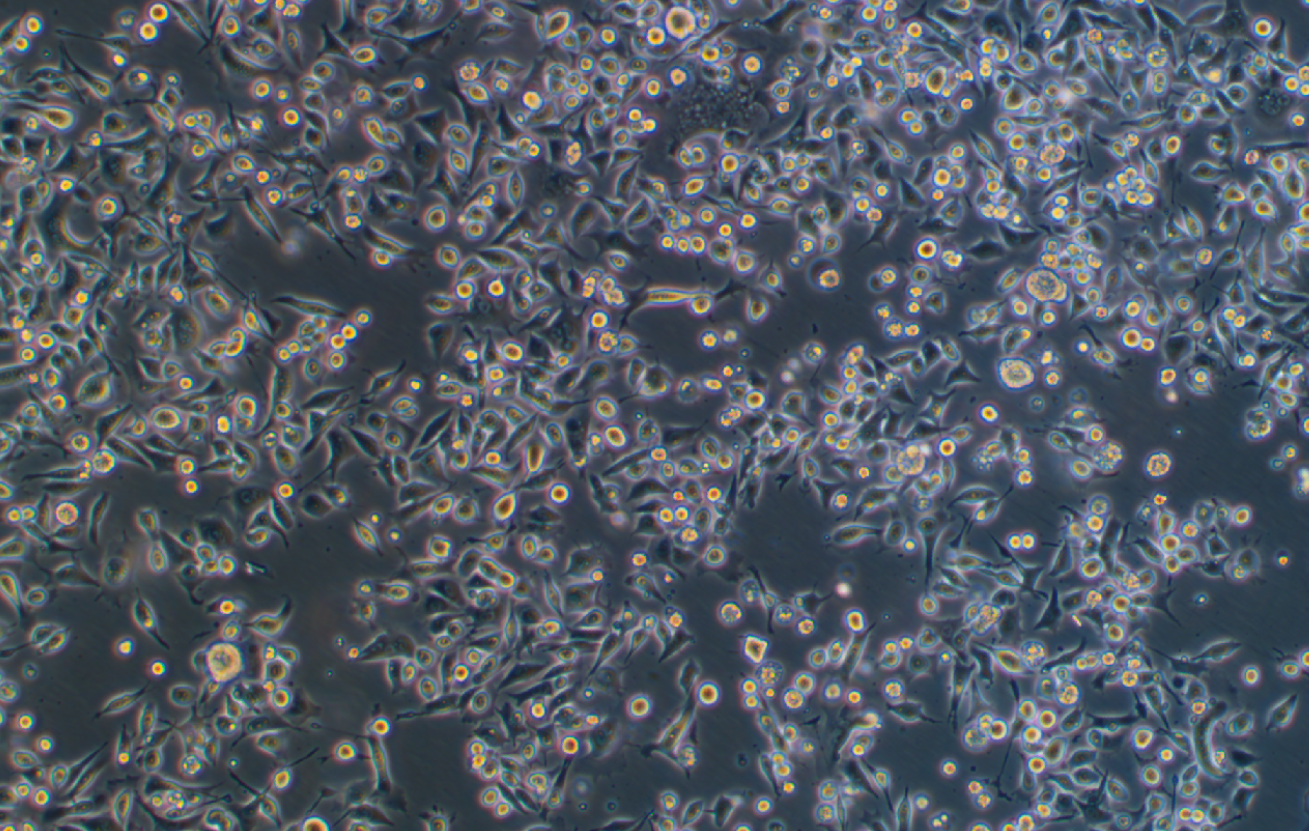 人胃癌細胞SNU601(STR鑒定正確)