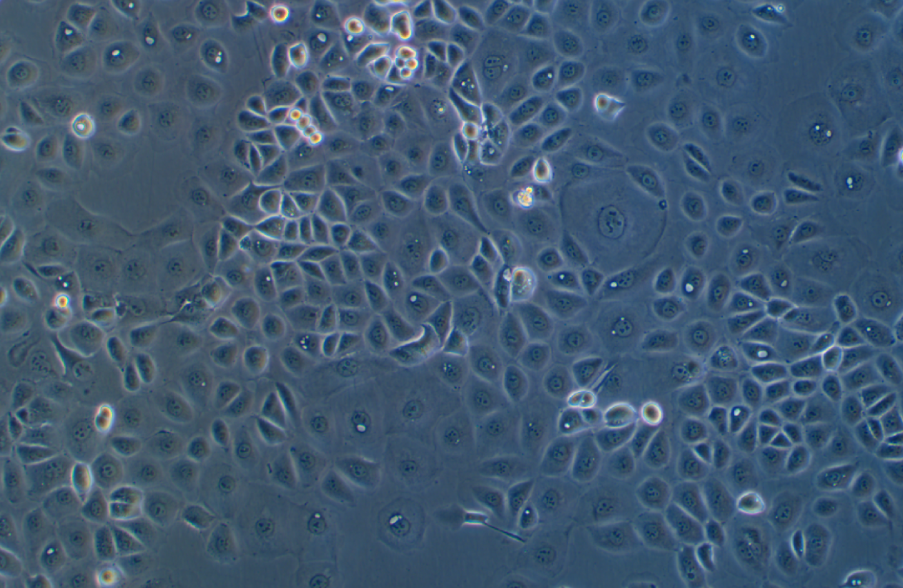 人卵巢癌腺癌細(xì)胞NIH:OVCAR-3(STR鑒定正確)