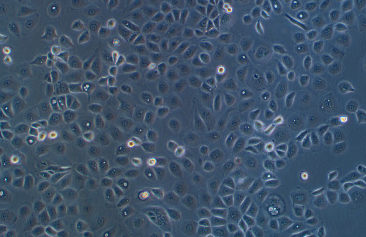 人卵巢癌腺癌細(xì)胞NIH:OVCAR-3(STR鑒定正確)