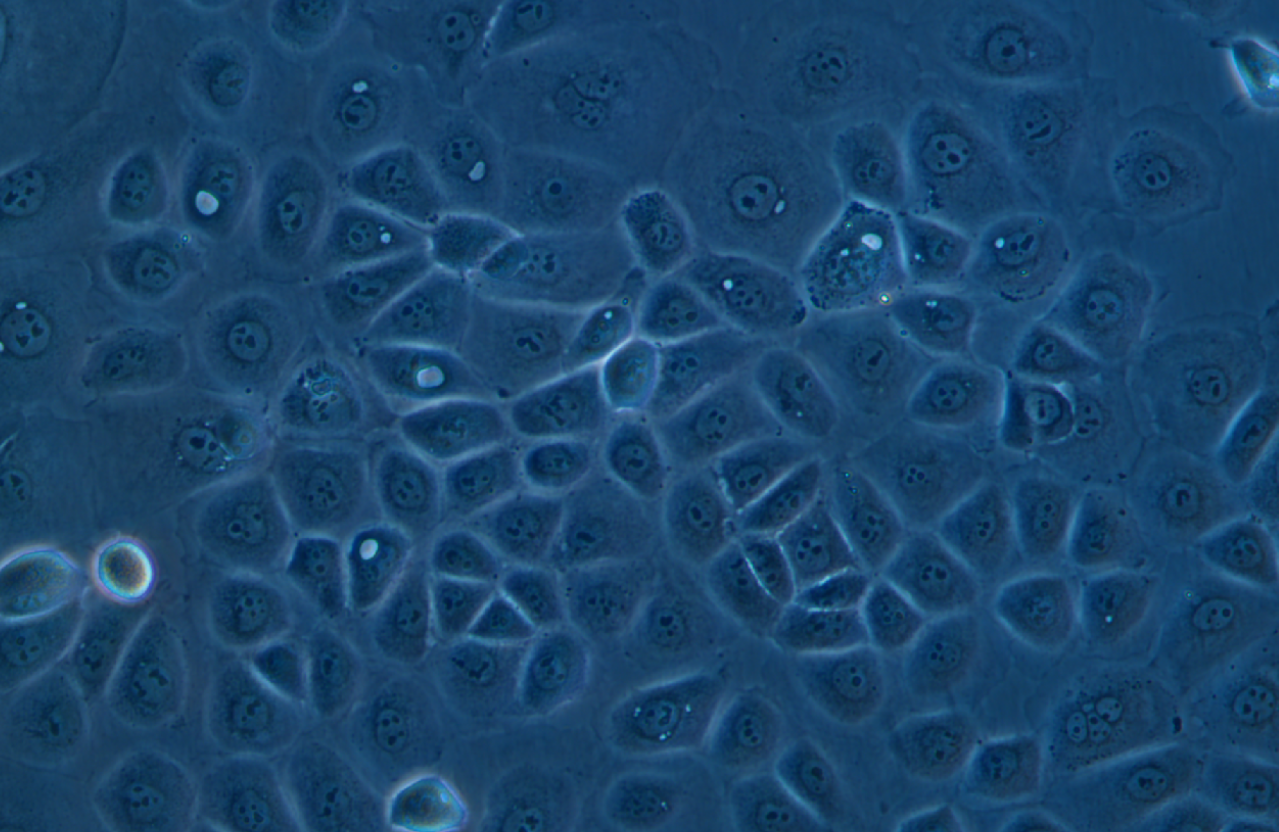 人卵巢癌腺癌細(xì)胞NIH:OVCAR-3(STR鑒定正確)