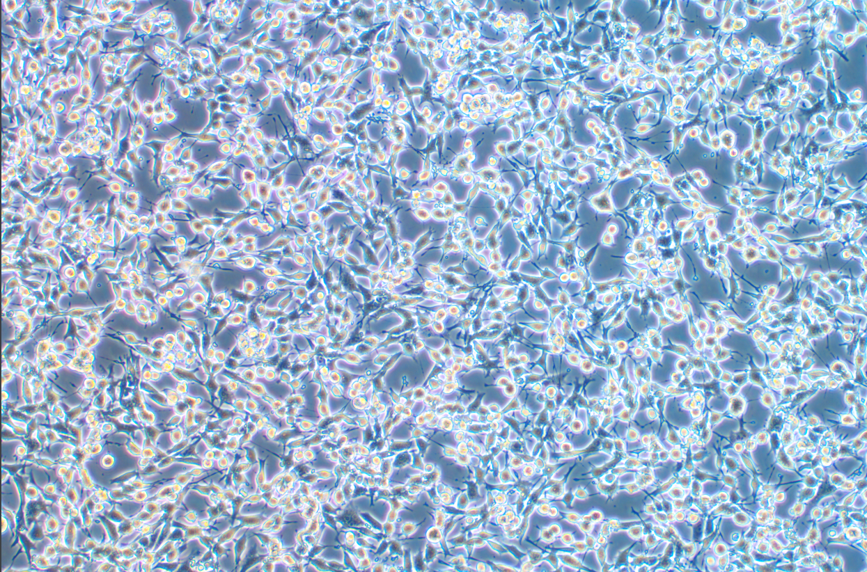 小鼠纖維肉瘤細(xì)胞系MCA205(STR鑒定正確)
