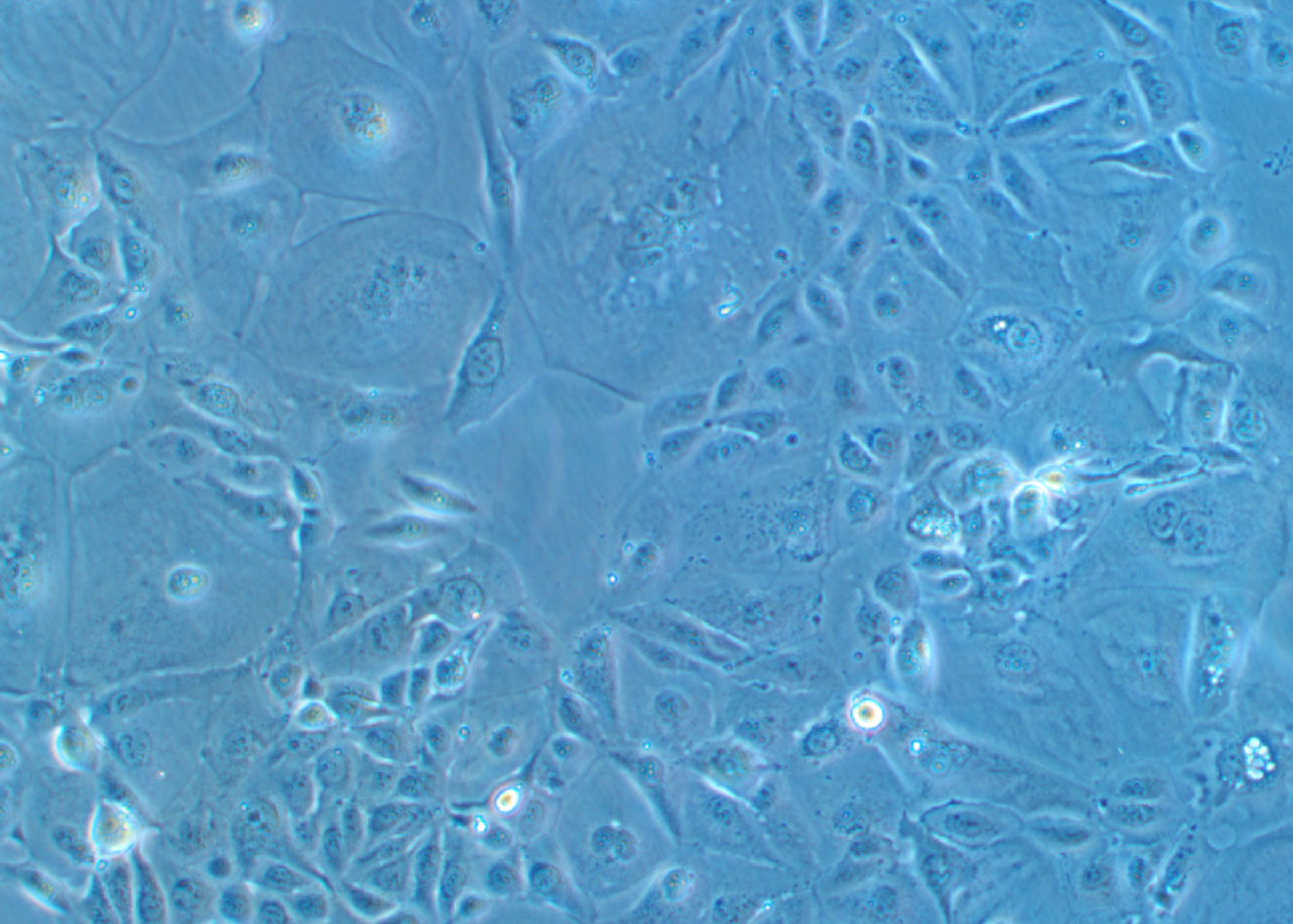 人肺腺癌細胞NCI-H3255(STR鑒定正確)