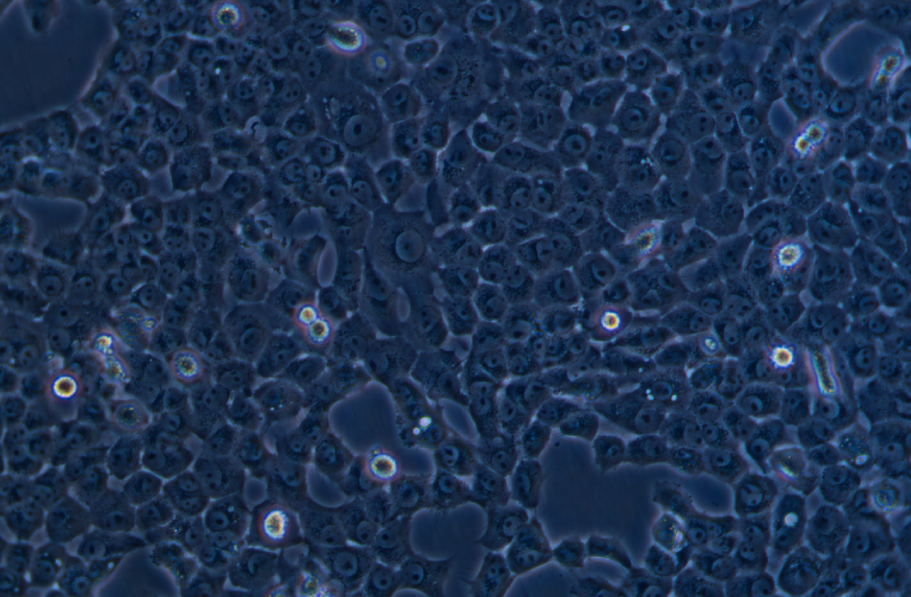 人舌鱗癌細胞 CAL 27(STR鑒定正確)
