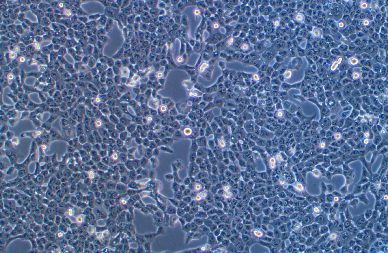 人舌鱗癌細胞 CAL 27(STR鑒定正確)