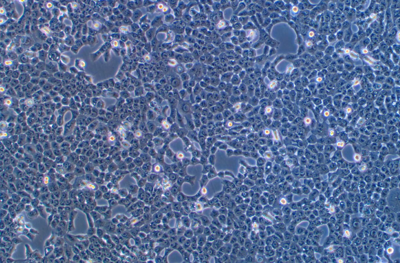 人舌鱗癌細胞 CAL 27(STR鑒定正確)
