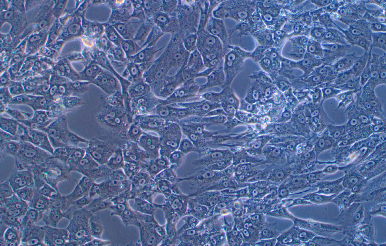 人雪旺細(xì)胞 (神經(jīng)纖維瘤病Ⅰ型)sNF96.2(STR鑒定正確)