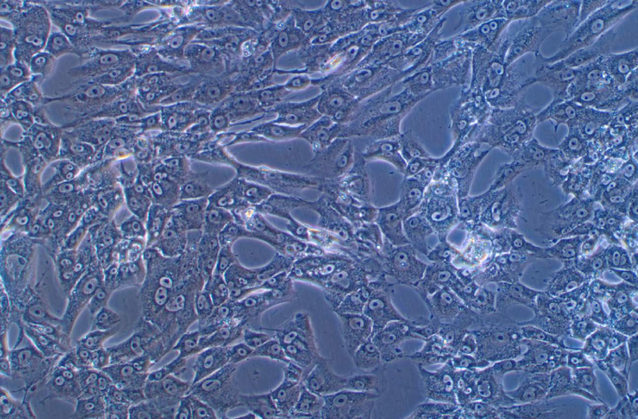 人雪旺細(xì)胞 (神經(jīng)纖維瘤病Ⅰ型)sNF96.2(STR鑒定正確)