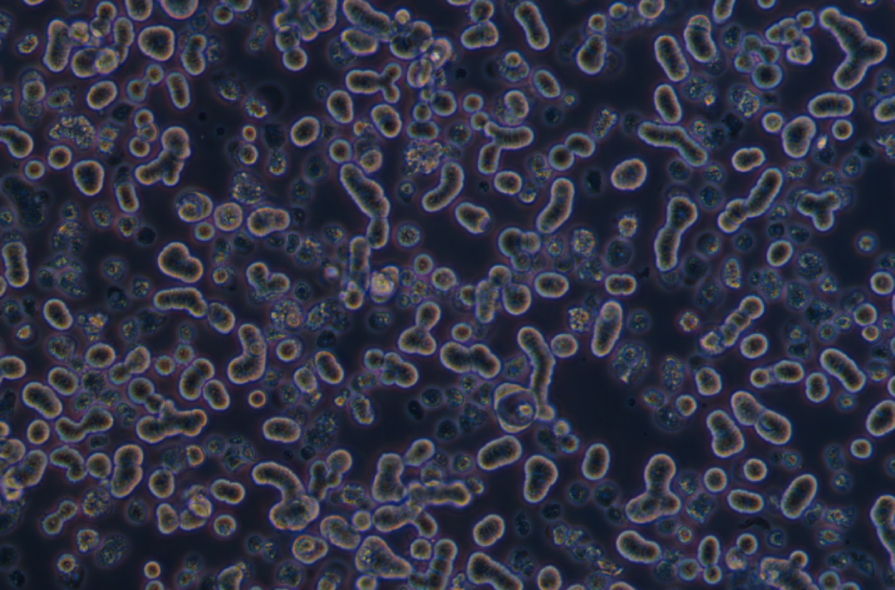 人乳腺上皮細胞DU4475(STR鑒定正確)