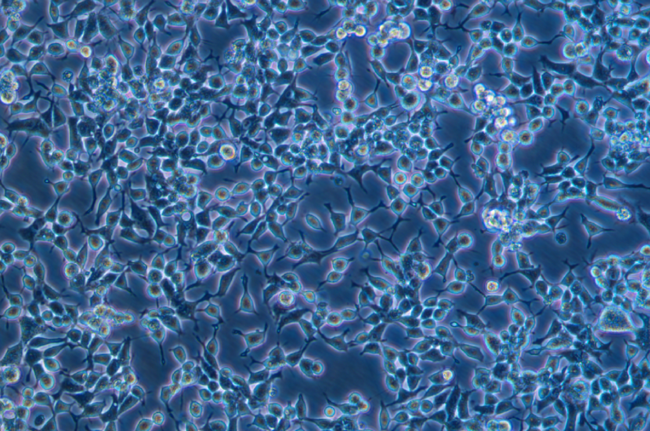 人鼻咽癌細胞C666-1(STR鑒定正確)