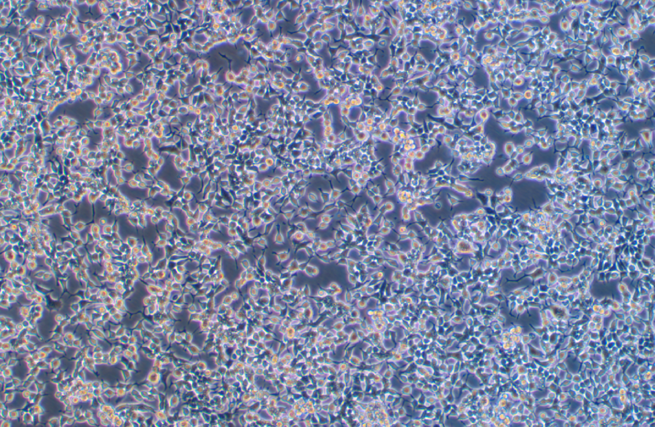 人鼻咽癌細胞C666-1(STR鑒定正確)