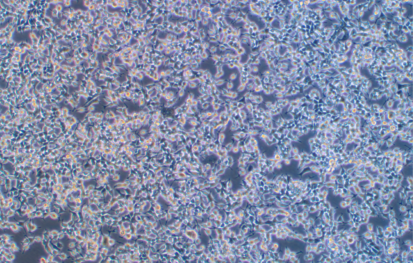 人鼻咽癌細胞C666-1(STR鑒定正確)