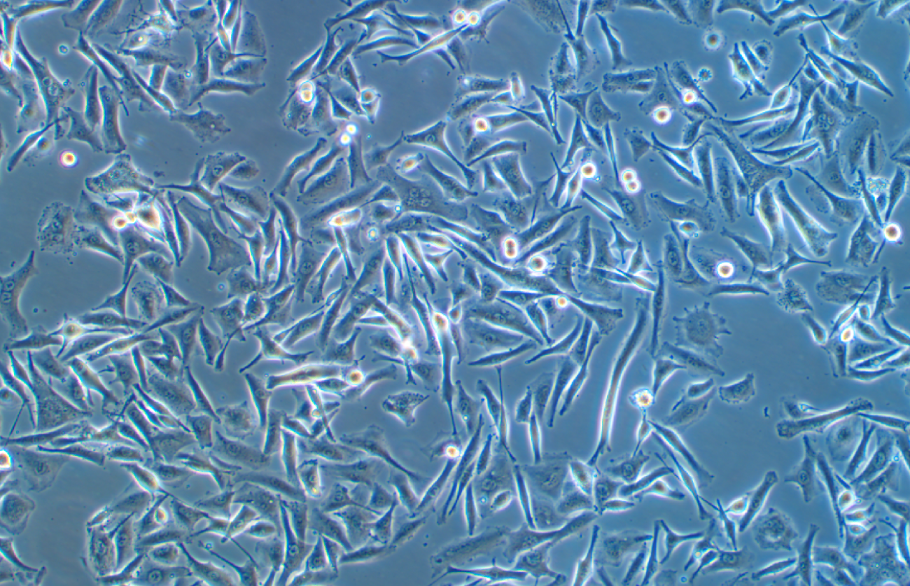 人皮膚惡性黑色素瘤Malme-3M(STR鑒定正確)