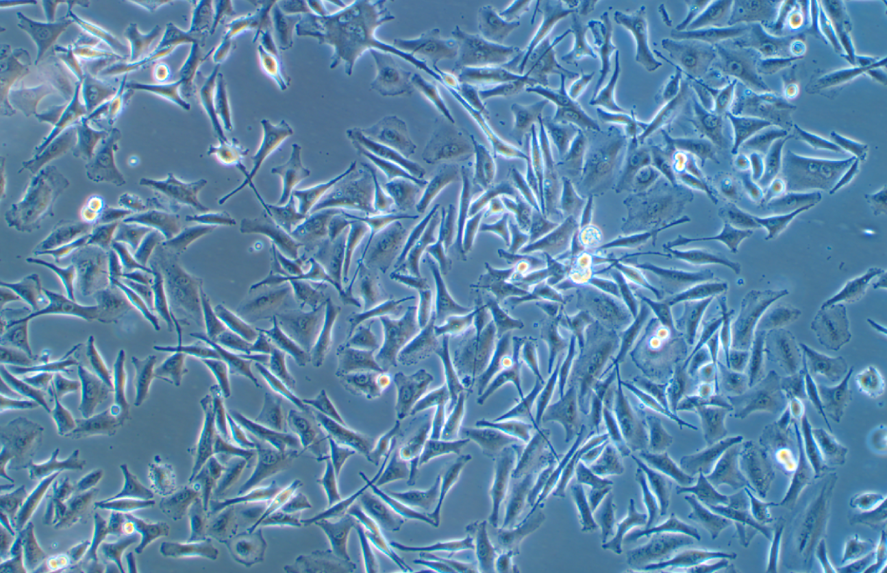 人皮膚惡性黑色素瘤Malme-3M(STR鑒定正確)