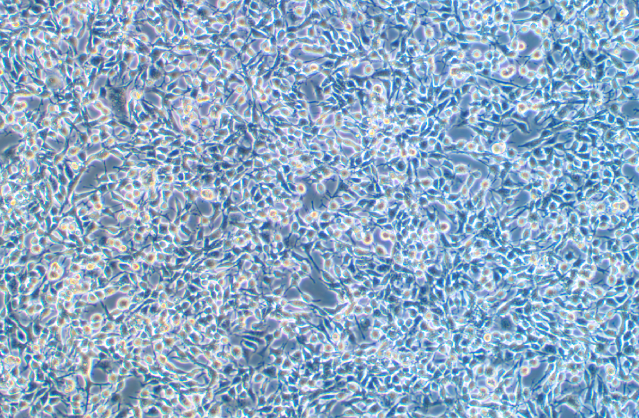 小鼠食管癌細胞AKR