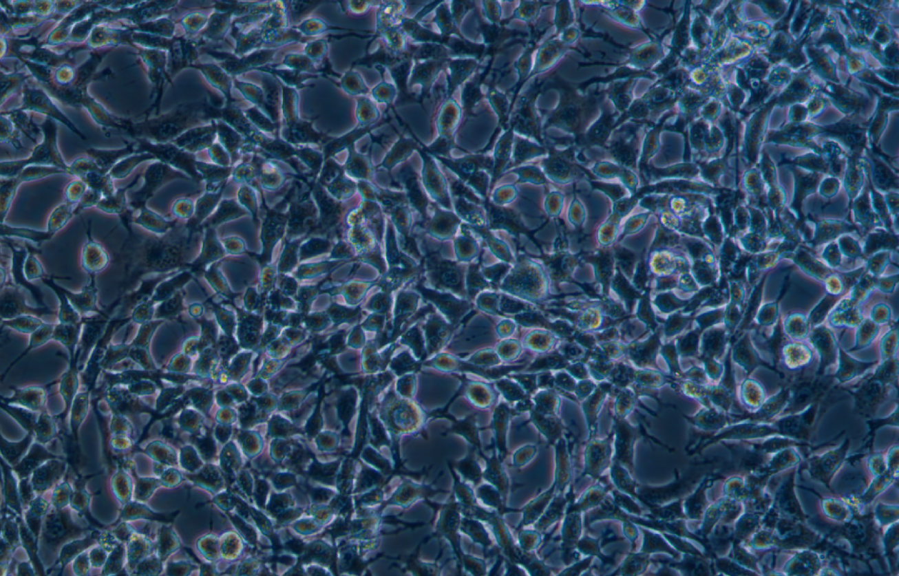 小鼠食管癌細胞AKR