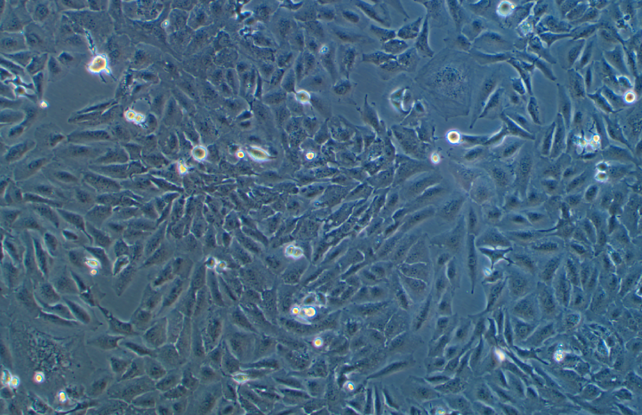 人卵巢癌細胞SKOV3 (STR鑒定正確)
