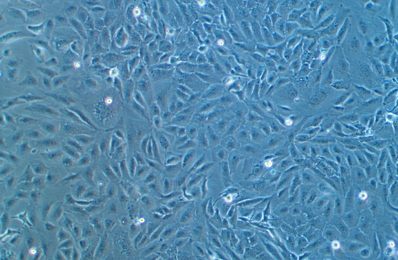 人卵巢癌細胞SKOV3 (STR鑒定正確)