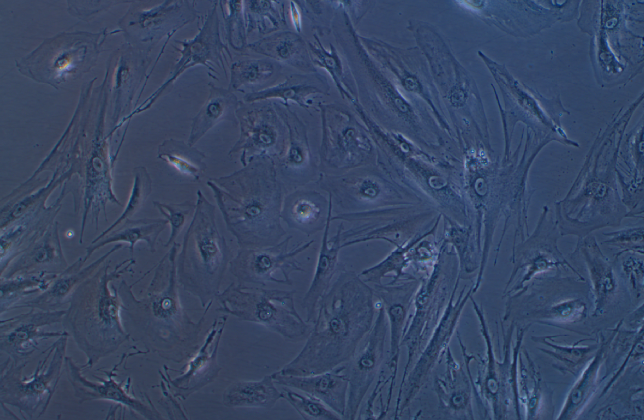 正常人結(jié)腸組織細(xì)胞 CCD-18Co(STR鑒定正確)