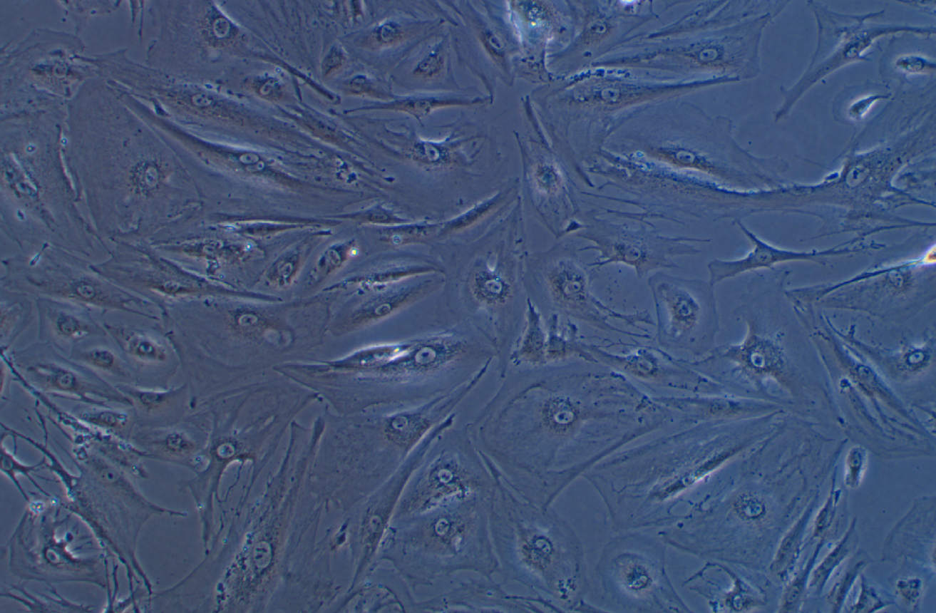正常人結(jié)腸組織細(xì)胞 CCD-18Co(STR鑒定正確)