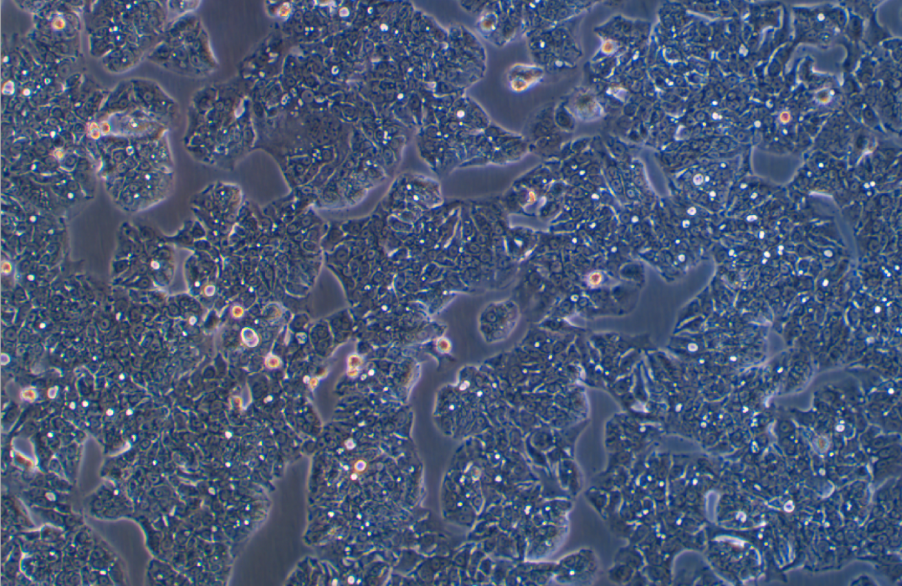 甲氨蝶呤誘導HT29細胞分化為成熟杯狀細胞HT29-MTX-E12(STR鑒定正確)