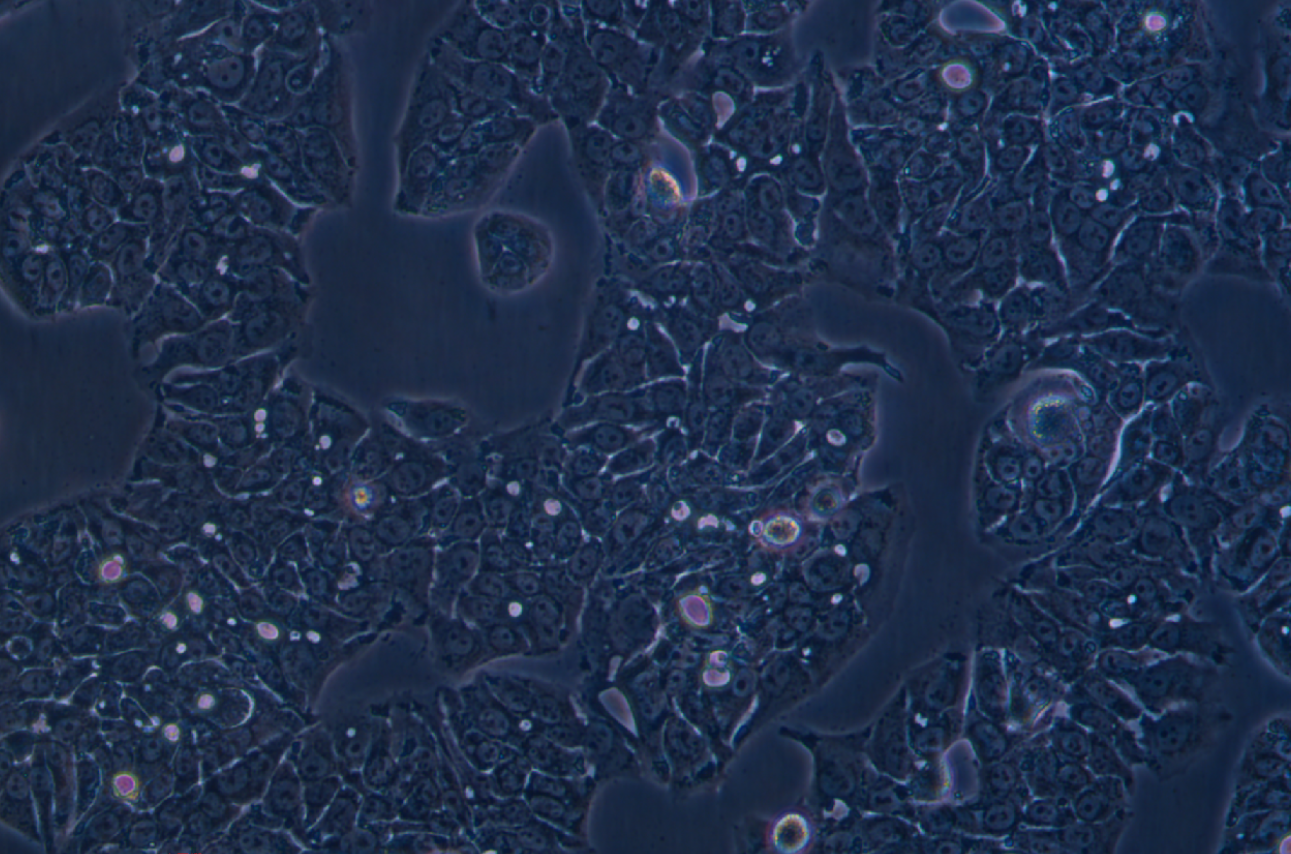 甲氨蝶呤誘導HT29細胞分化為成熟杯狀細胞HT29-MTX-E12(STR鑒定正確)