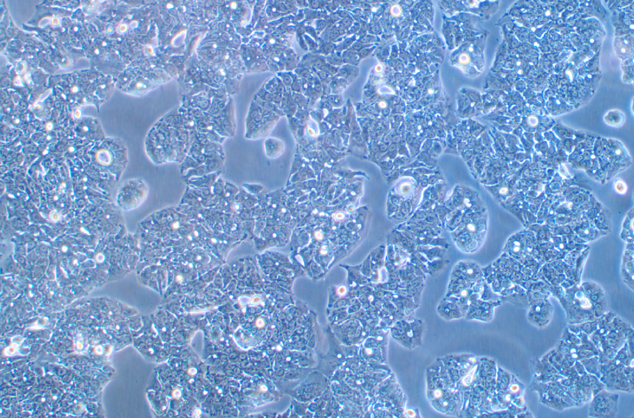 甲氨蝶呤誘導HT29細胞分化為成熟杯狀細胞HT29-MTX-E12(STR鑒定正確)