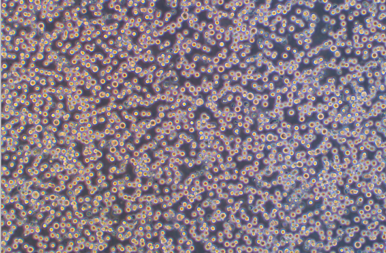 人成巨核細胞白血病細胞MEG-01(STR鑒定正確)